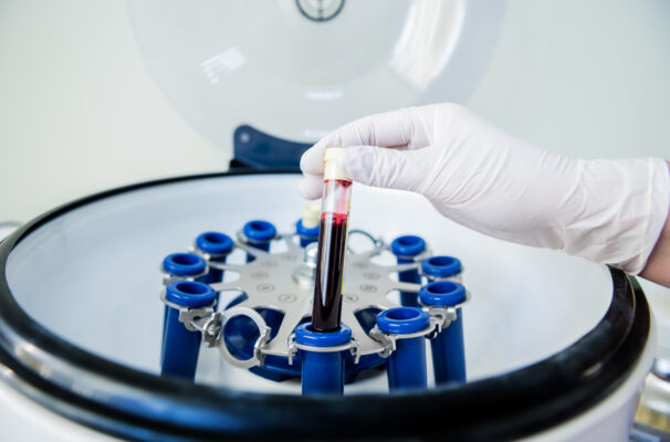 L-PRF in Norcross, GA | Free Screenings for Holistic Healing