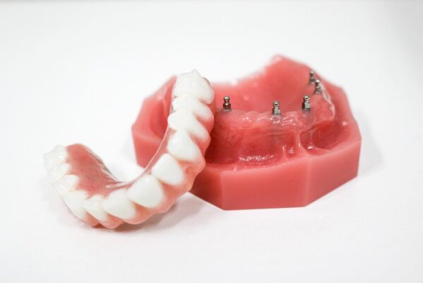 Best Implant Options in 2026 in Norcross, GA [Video Walkthrough]