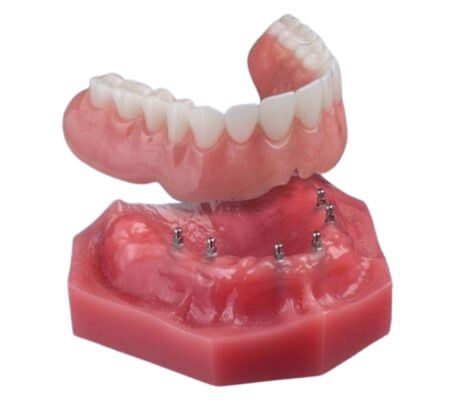 Snap-In Dentures in Norcross, GA | Free Screenings [Video Tips]
