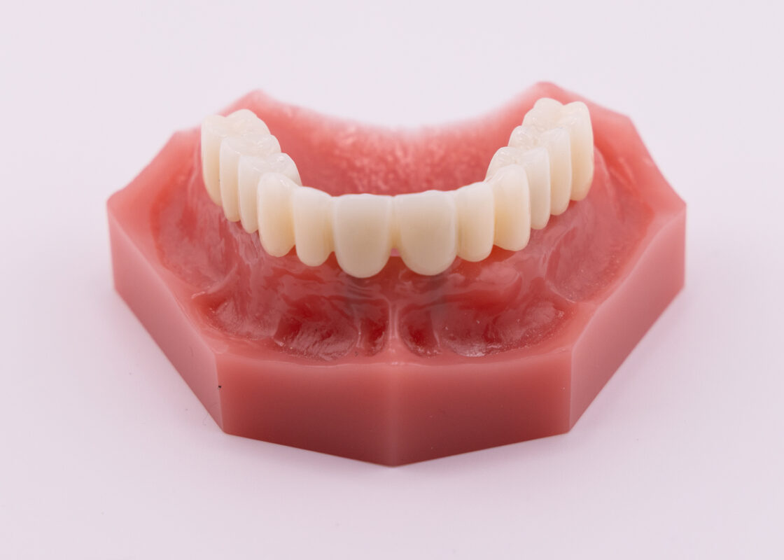 Full Mouth Dental Implants in Norcross, GA | Free Screenings